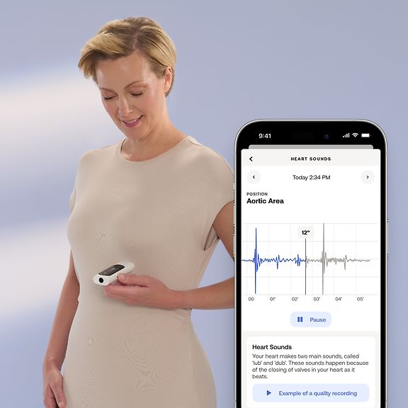Withings BeamO 4-in-1-terveydenseurantatyökalu – kuva 8